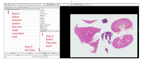 Image result for QuPath Image Analysis