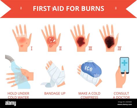 Burn skin. First treatment human hand fire or chemical destruction injury graviera skin safety ...