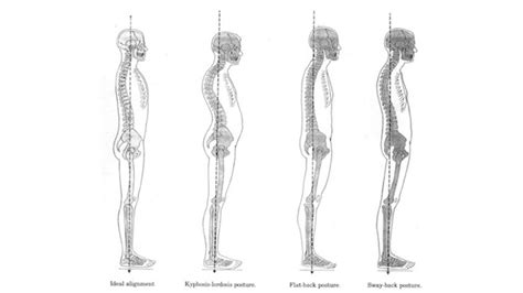 Body Alignment Test 的图像结果
