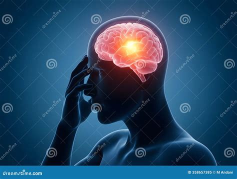 Headache Pain Relief Brain Anatomy Illustration Stock Illustration - Illustration of patient ... - headache and pain relief