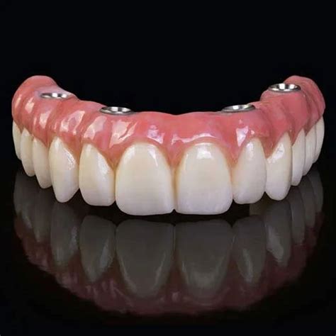 Dentures in Chennai & Cuddalore | BPS & Hybrid Dentures | CM Dental Clinic