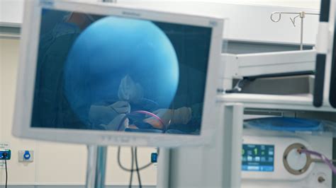 Operating Room Camera 的图像结果