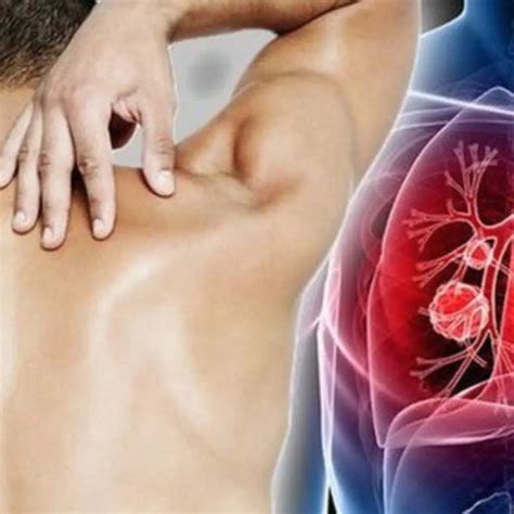 A 29-year-old man unexpectedly discovered he had lung cancer and admitted to a mistake many ...