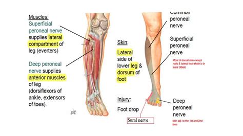 What Causes Drop Foot