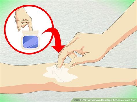 Doctor-Approved Advice on How to Remove Bandage Adhesive from Skin