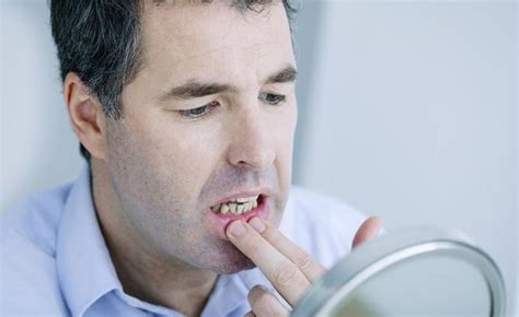 牙龈出血是小事？若是发生频率过高，也可能会暗藏疾病