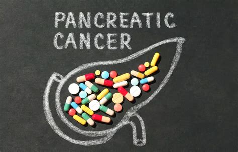 AI Detects Pancreatic Cancer More Accurately Than Radiologists, Finds ...