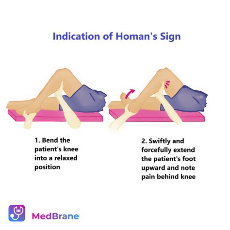 Mastering Pulmonary Embolism: Key Insights | MedBrane