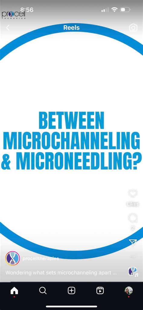 Evening of Education - Microneedling explained, 4913 51 St, Stettler ...