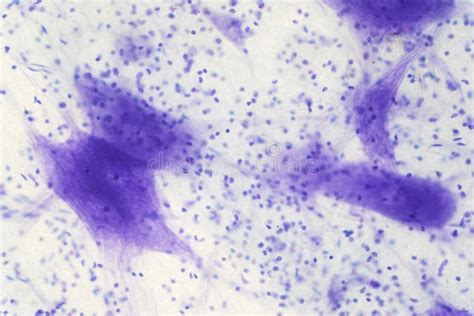 Image result for Brain Under Microscope