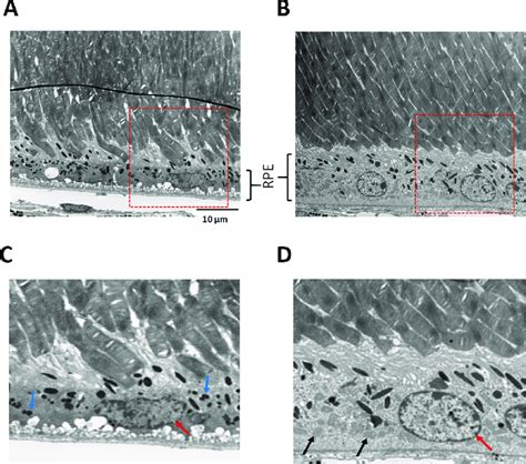 Image result for RPE Hexagonal Structure
