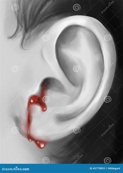 Pierced Ears Bleeding at Noma Andrews blog