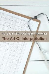 12-lead Ecg And Heart Rhythms_ The Art Of Interpretation: Buy 12-lead ...
