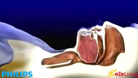 Philips Respironics Sleep Apnea Care