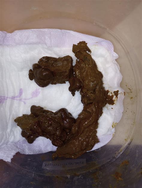 Bloody mucus in stool? : r/poop
