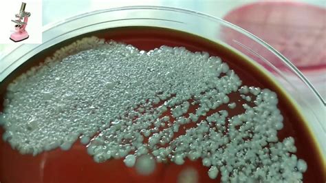 What Does Mixed Flora In A Urine Culture Mean at Elsie Tucker blog