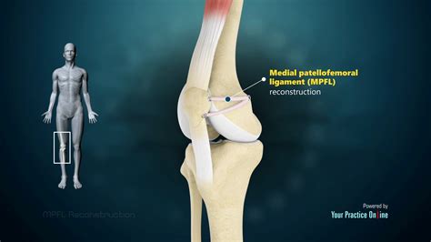 Medial Patellofemoral Ligament Patella (Kneecap): Anatomy And Function