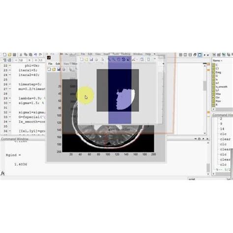 Image result for Medical Image Segmentation MATLAB