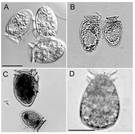 A Long-Term Time Series of Dinophysis acuminata Blooms and Associated ...