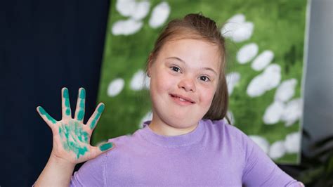 Ternyata Ada 3 Jenis Kelainan Genetik Down Syndrome, Simak Perbedaannya ...