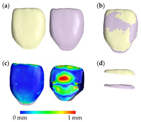Longitudinal 3D Study of Anterior Tooth Wear from Adolescence to ...
