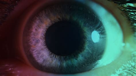 Dealing With Concussion Symptoms: Light Sensitivity | Complete Concussions