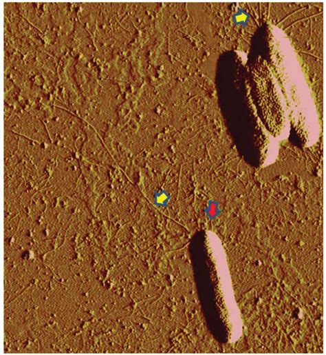 Genes | Special Issue : Genes and Genomes of Plant Pathogenic Bacteria