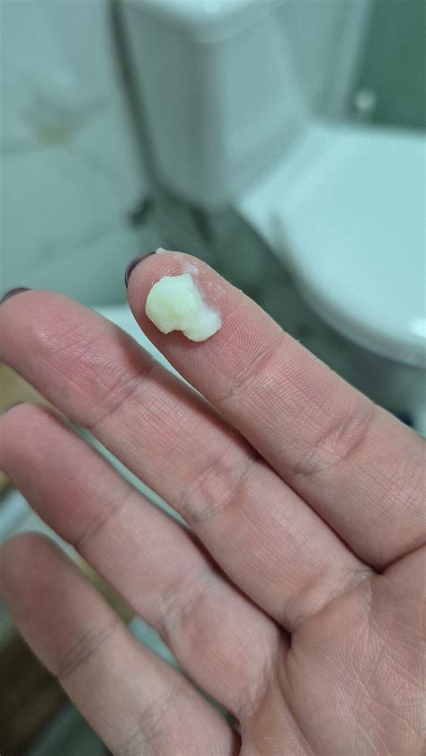 Muco branco | BabyCenter