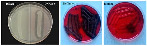 Dairy Cows’ Udder Pathogens and Occurrence of Virulence Factors in ...