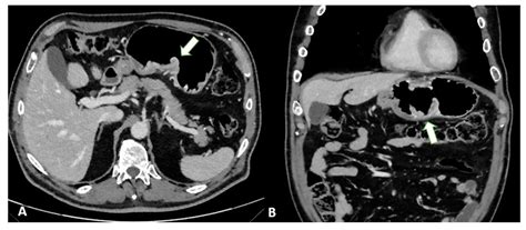 Imaging in Gastric Cancer: Current Practice and Future Perspectives