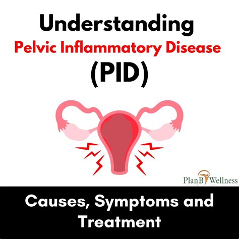 Understanding Pelvic Inflammatory Disease: Causes, Symptoms, and Treatment – Plan B Wellness