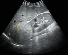 Renal US için 27 fikir | radyo, radyoloji, uzman veterinerlik