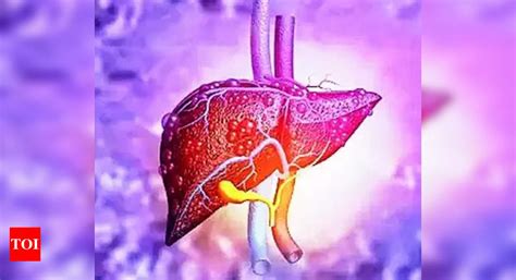 Liver Cirrhosis: Pgi’s Succour: New Procedure Offers Cheaper, Better ...