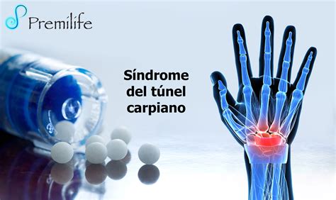 Carpal Tunnel In Spanish Definition at Jennifer Carranza blog