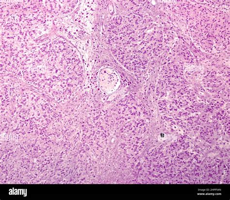 Human pineal gland lobulation, light micrograph Stock Photo - Alamy