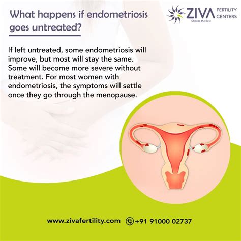 What Happens If Endometriosis Goes Untreated