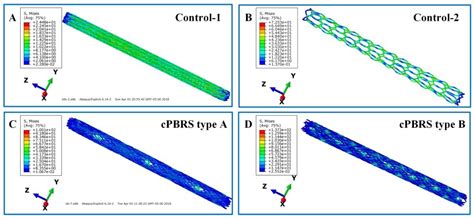 The Crimping and Expanding Performance of Self-Expanding Polymeric ...