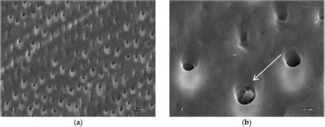 Dentine Surface Morphology after Chlorhexidine Application—SEM Study