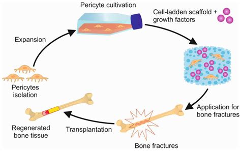 The Therapeutic Potential of Pericytes in Bone Tissue Regeneration[v1 ...