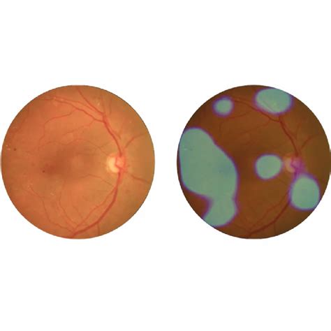 Ophthalmic Equipments & Hospital Furniture - Eye Care Hospital ...