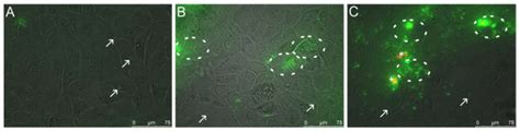 Cytokine-Mediated Inflammation in the Oral Cavity and Its Effect on ...