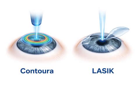 How Long Does an Eye Exam Takes? InSight Vision Center