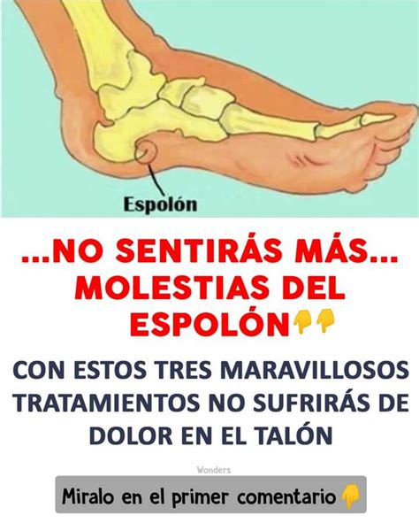 Tratamientos para el espolón y como disminuir el dolor. « Todo Nathy