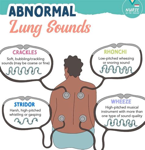 Abnormal Lung Sounds - MEDizzy