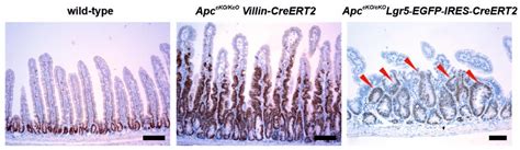 Human Colorectal Cancer from the Perspective of Mouse Models