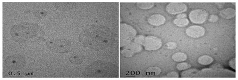 Ezetimibe-Loaded Nanostructured Lipid Carrier Based Formulation ...