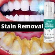 Toothsi 2 gen Teeth Whitening liquid Price in India - Buy Toothsi 2 gen ...