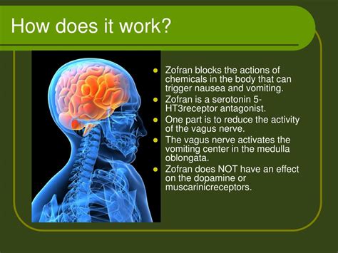 PPT - Ondansetron PowerPoint Presentation, free download - ID:365119