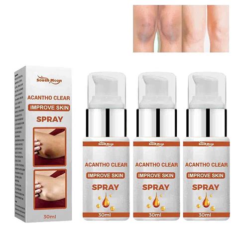 Acantho Clear Therapy Spray, Acanthosis Nigricans | Ubuy India