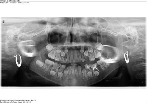 Byte Array From Object Detection 的图像结果